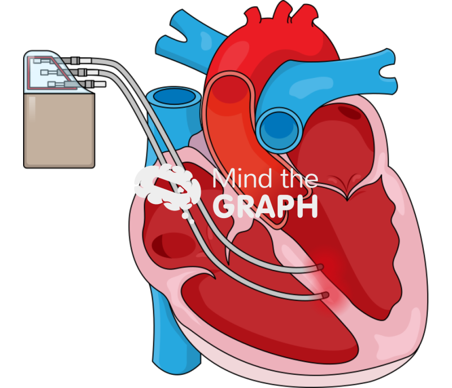 Cardiac contractility modulation therapy Icons, Symbols, Pictures, and Images